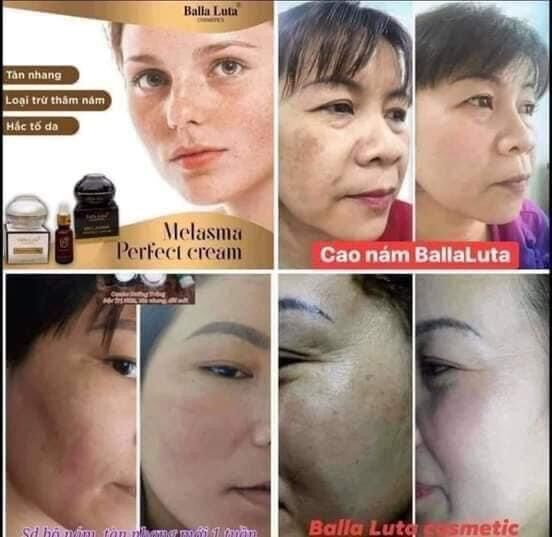 [HCM]SERUM THẢO DƯỢC BALLA LUTA