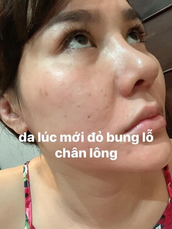TÁI TẠO DA HỒNG SÂM + BỘT RỬA MẶT <HÀNG CHÍNH HÃNG CTY>