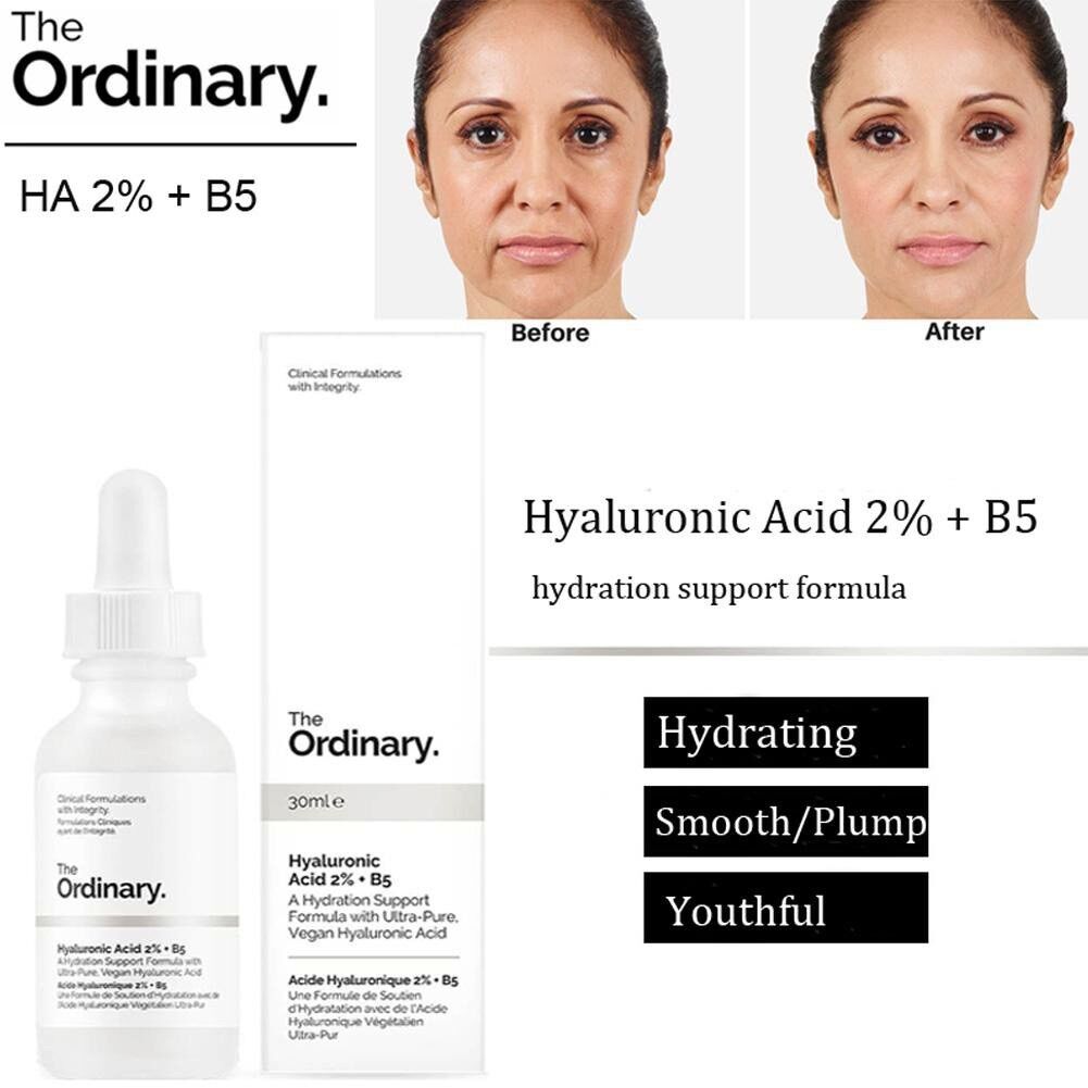 [Chính hãng] Ha + B5 The Ordinary 30ml