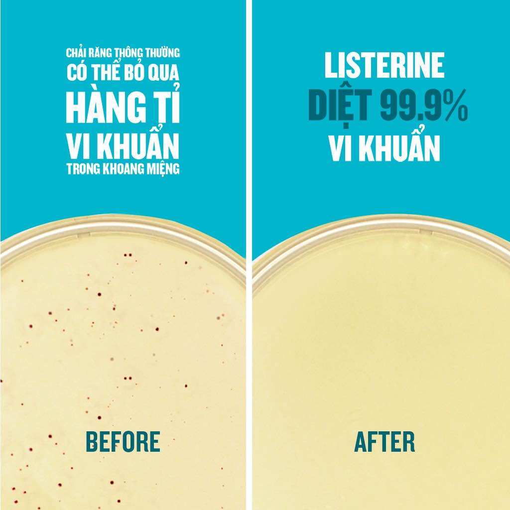 NƯỚC SÚC MIỆNG LISTERINE THÁI LAN 750ml & 250ML