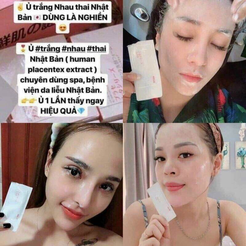 [Hcm]????Hộp 50 Miếng Serum Nhau Thai Cừu Ủ Trắng Nhật Bản