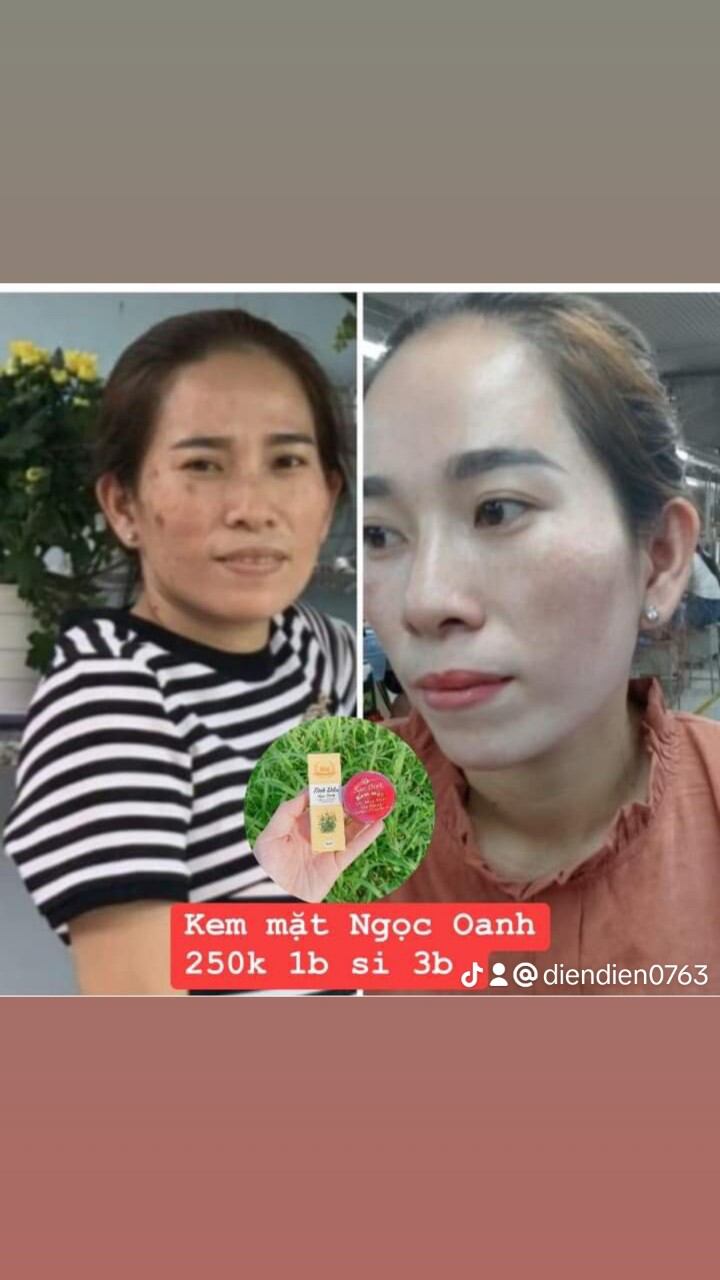 kem face Ngọc Oanh