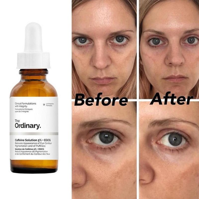 [Chính hãng][Siêu rẻ] Tinh chất dưỡng vùng mắt The Ordinary Caffeine Solution 5% + EGCG date 2026