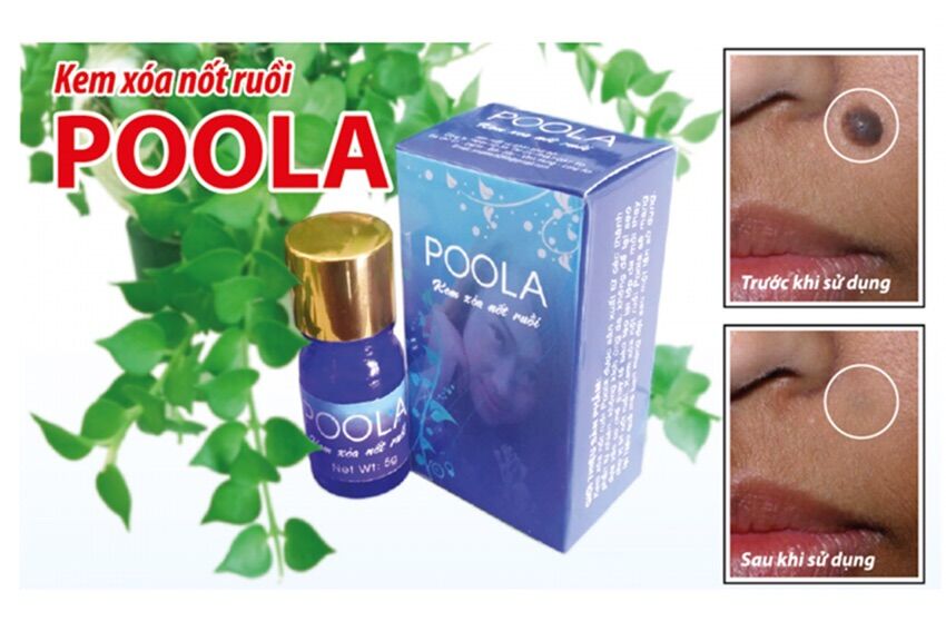 Kem Tẩy Xoá nốt ruồi tàn nhang Poola hàng chính hãng
