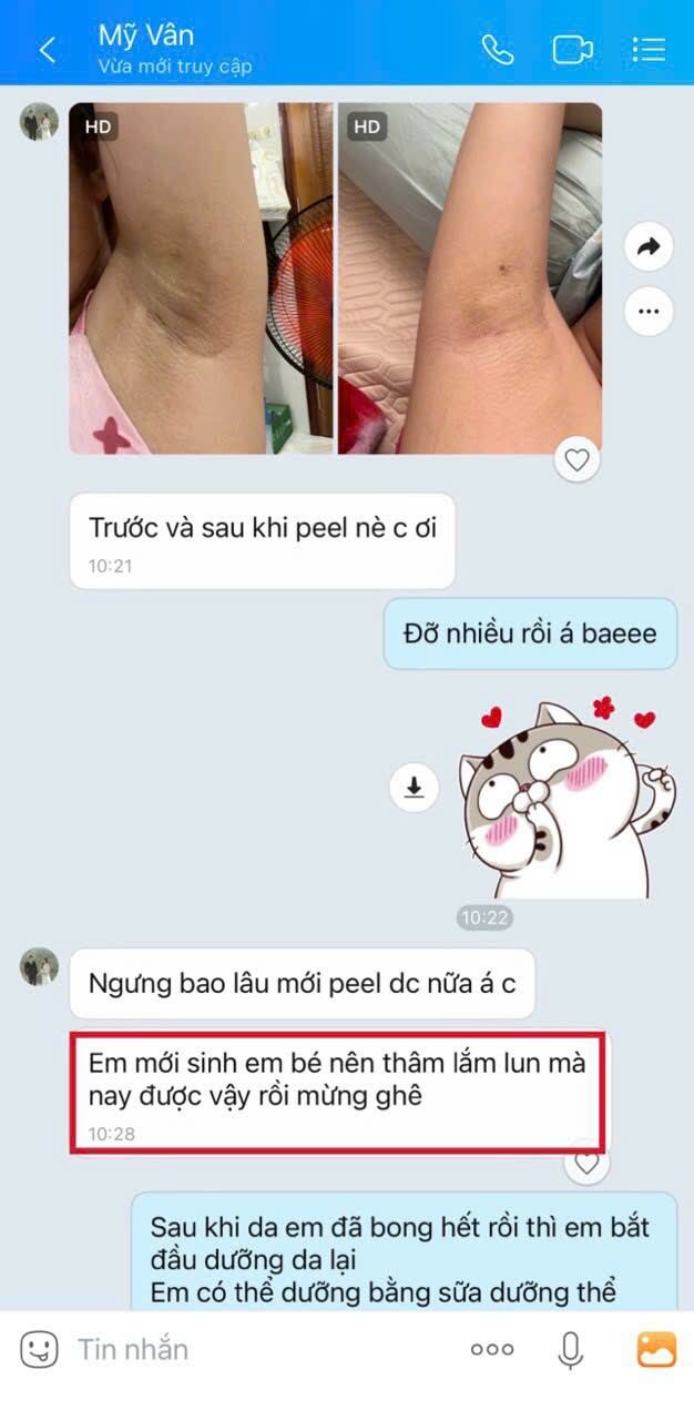 peel body,peel nach lepeau
