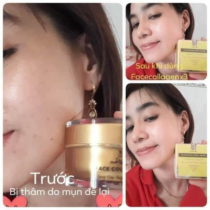 [HCM]KEM FACE COLLAGEN X3 ĐÔNG ANH
