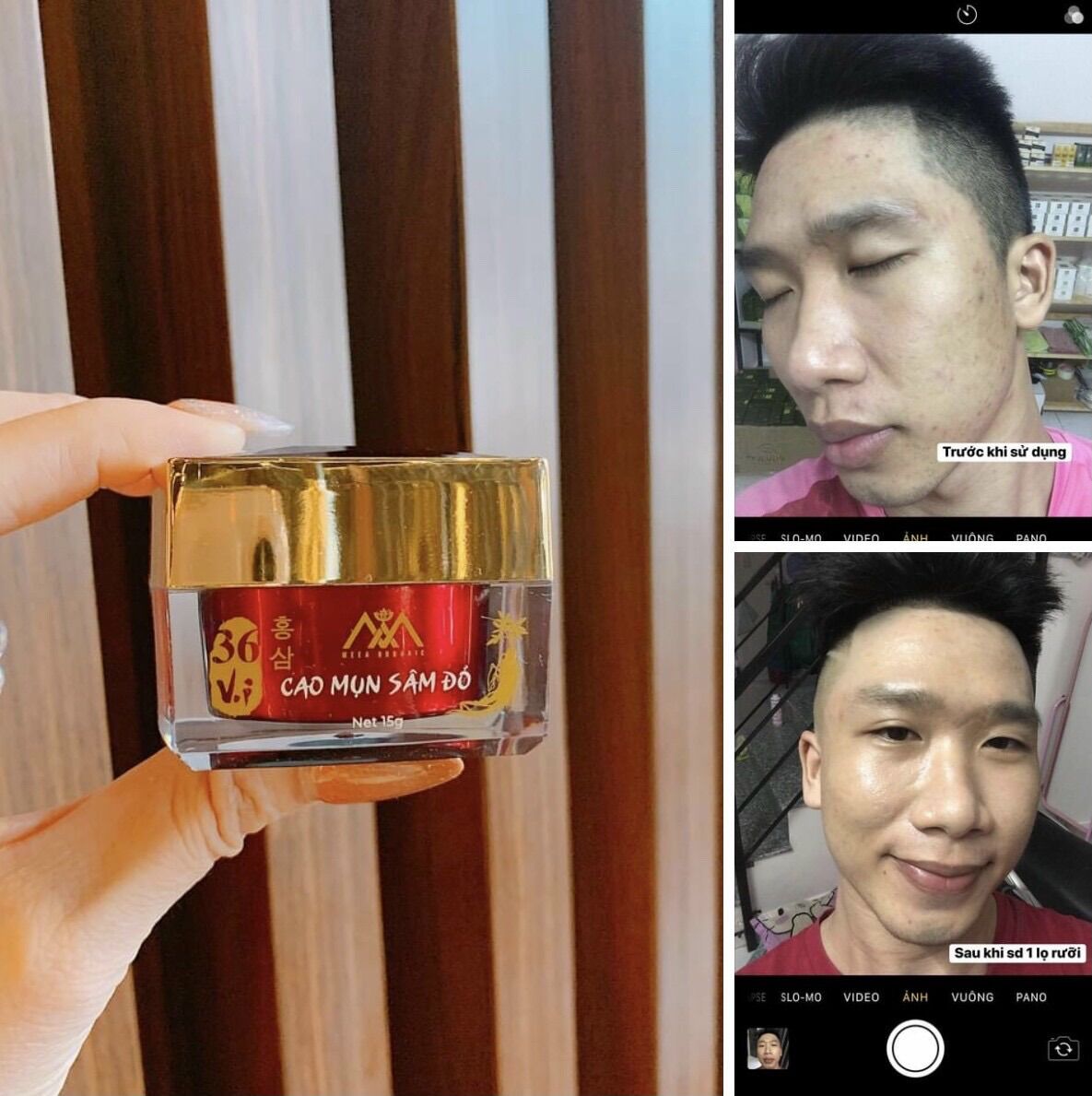 Hủ to Cao mụn sâm đỏ 36 vị 15gr