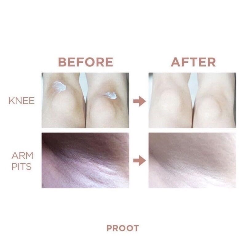 Kem mờ thâm body Vivid White