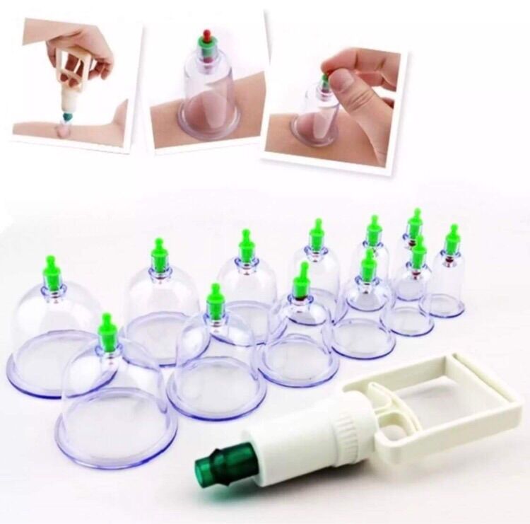 Bộ 12 ống giác hơi chân không không dùng lửa