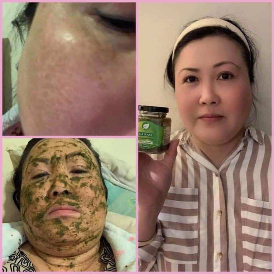 Cao lá nam tr.ị mụn, nám tàn nhang