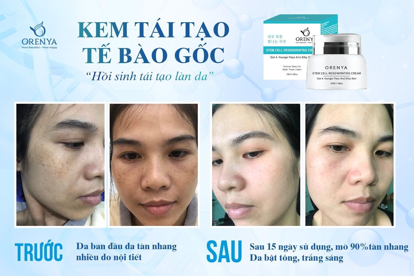 Kem tái tạo tế bào gốc