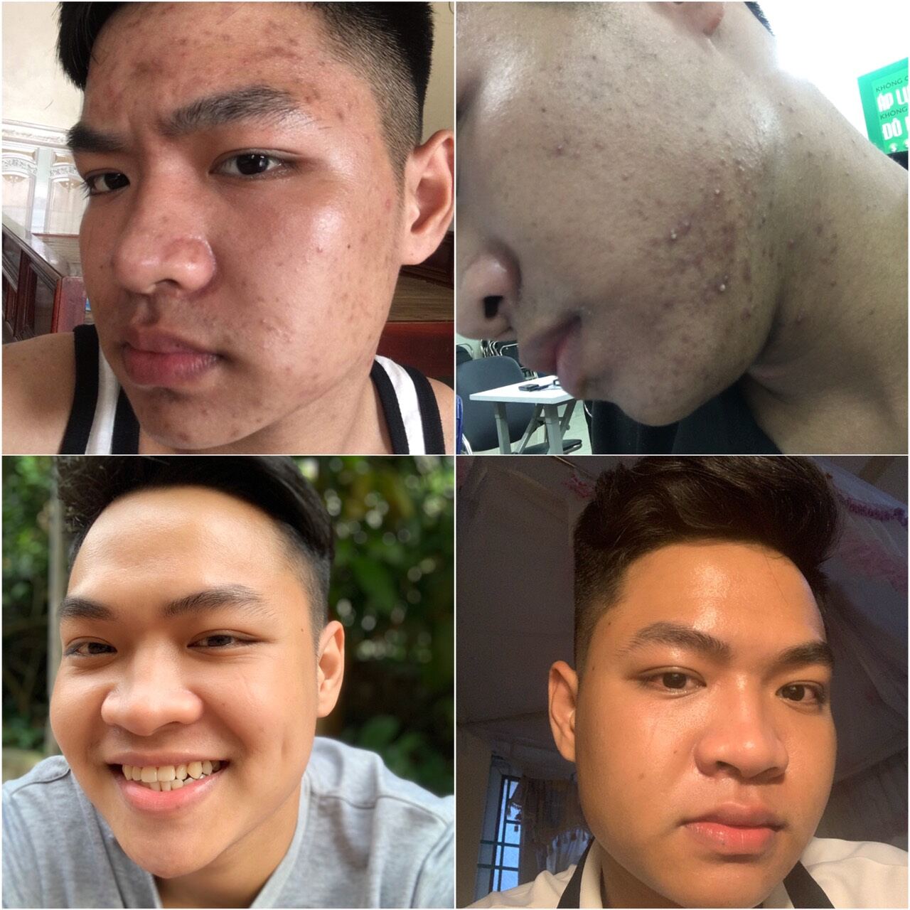 combo2 tinh chất Hoàng Thiên Sâm