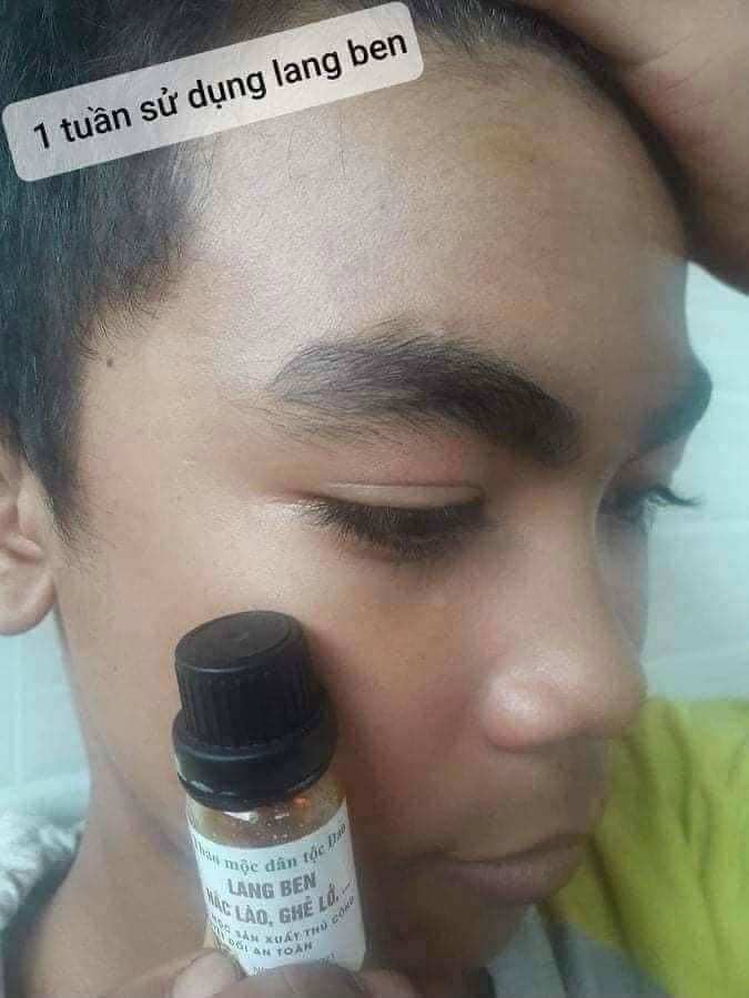 THẢO MỘC LANG BEN TRẦN KIM HUYỀN 15ML