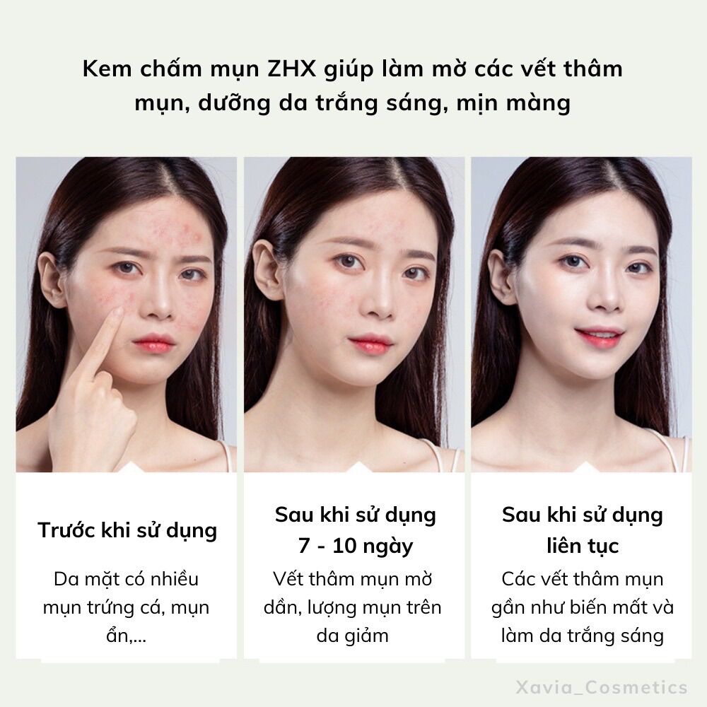 Kem chấm mụn ZHX