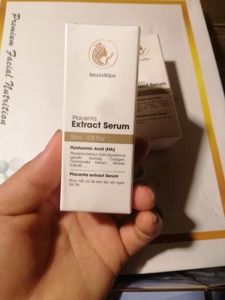 Serum nhau thai cừu mh spa