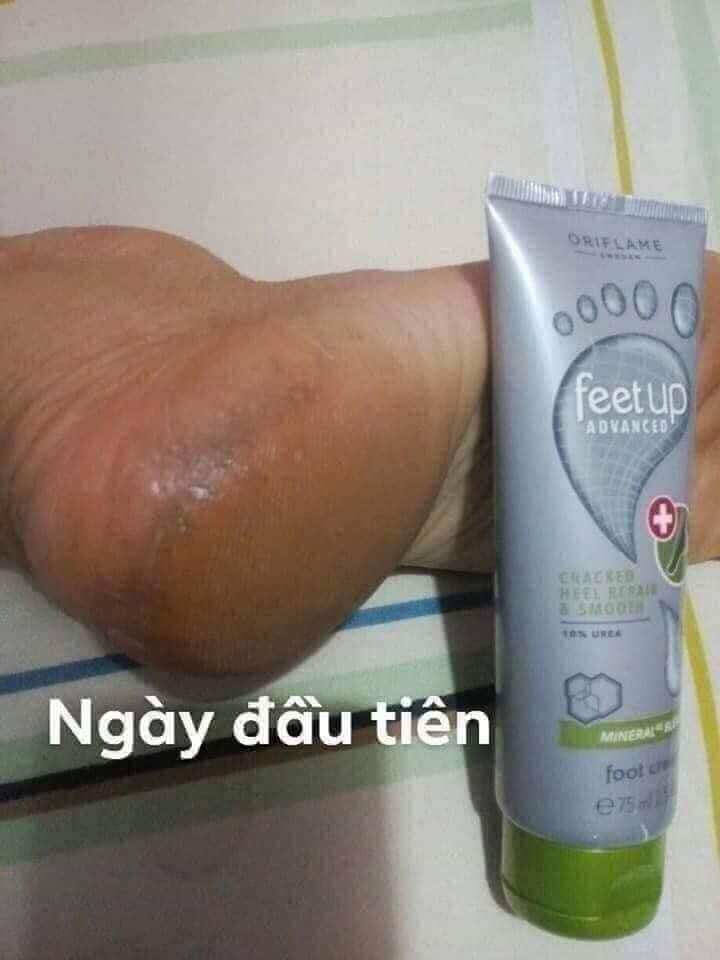 Kem Dưỡng ẩm  nứt gót da chân oriflame