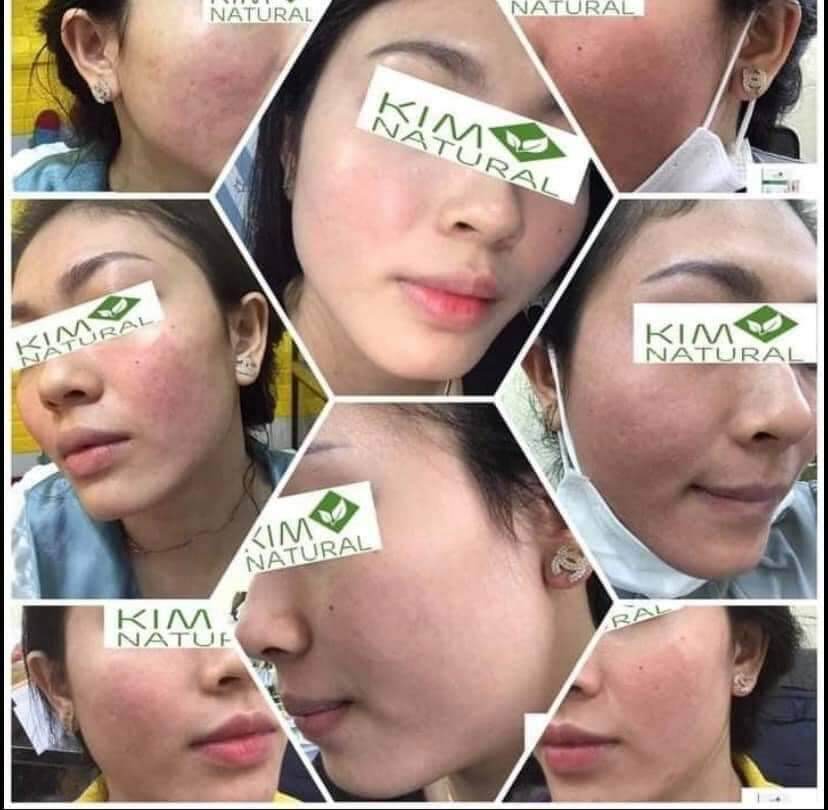 COMBO SERUM TRÀ XANH VIP TÁI TẠO LÀN DA
