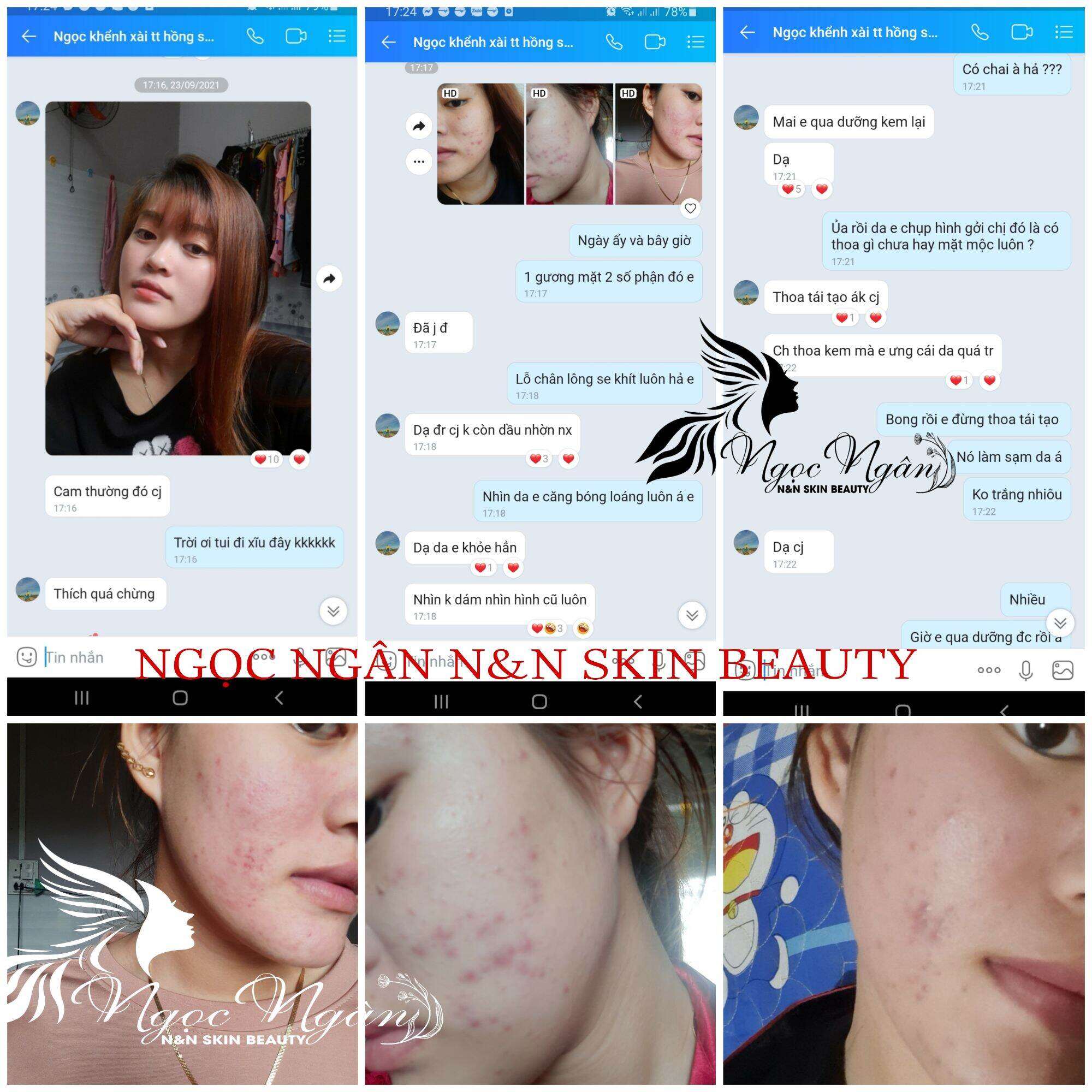 TÁI TẠO HỒNG SÂM