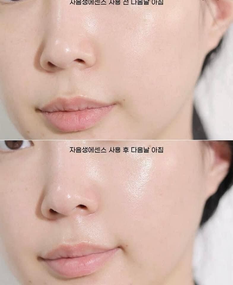 TINH CHẤT DƯỠNG DA SULWHASOO FIRST CARE ACTIVATING SERUM