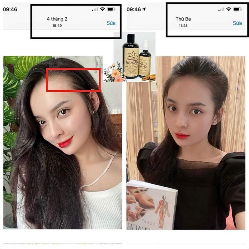 💥GIAO HỎA TỐC💥 DẦU GỘI ĐẦU THẢO DƯỢC MANDALA