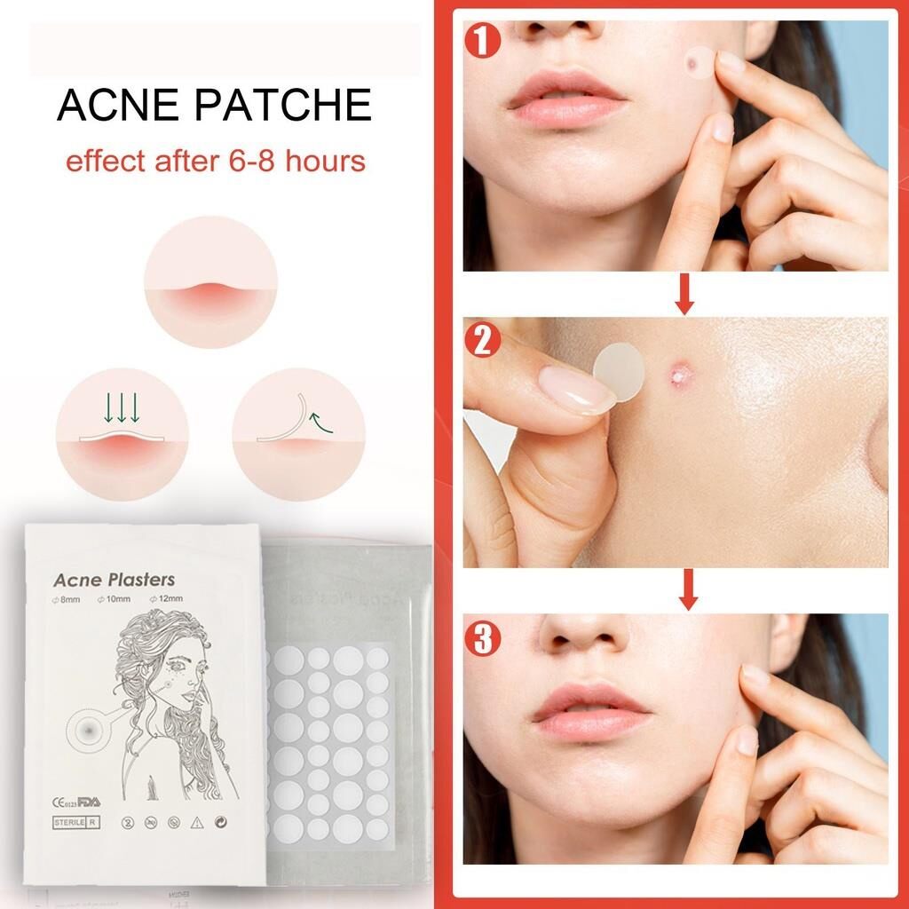 Set 36 miếng dán che mụn, che khuyết điểm bảo vệ da