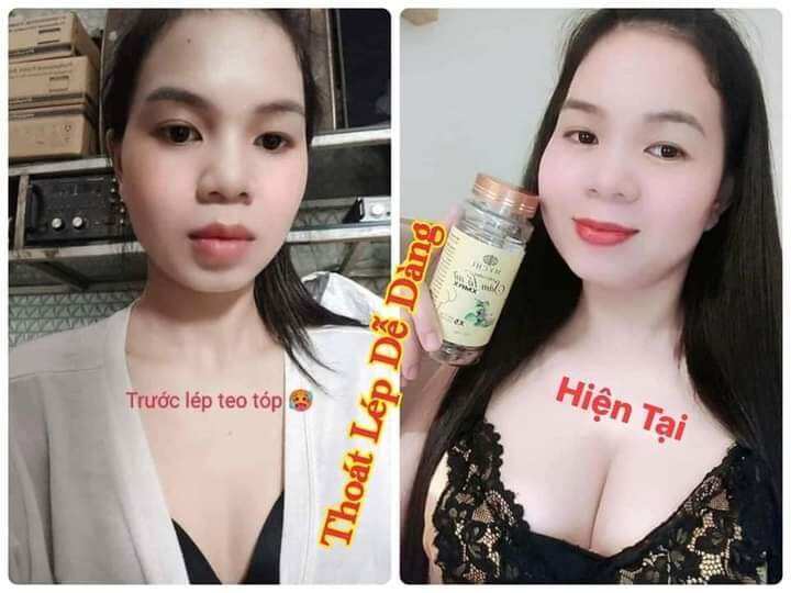 5 hộp Kẹo mầm Sâm Tố Nữ Xmax (tặng dây đo)