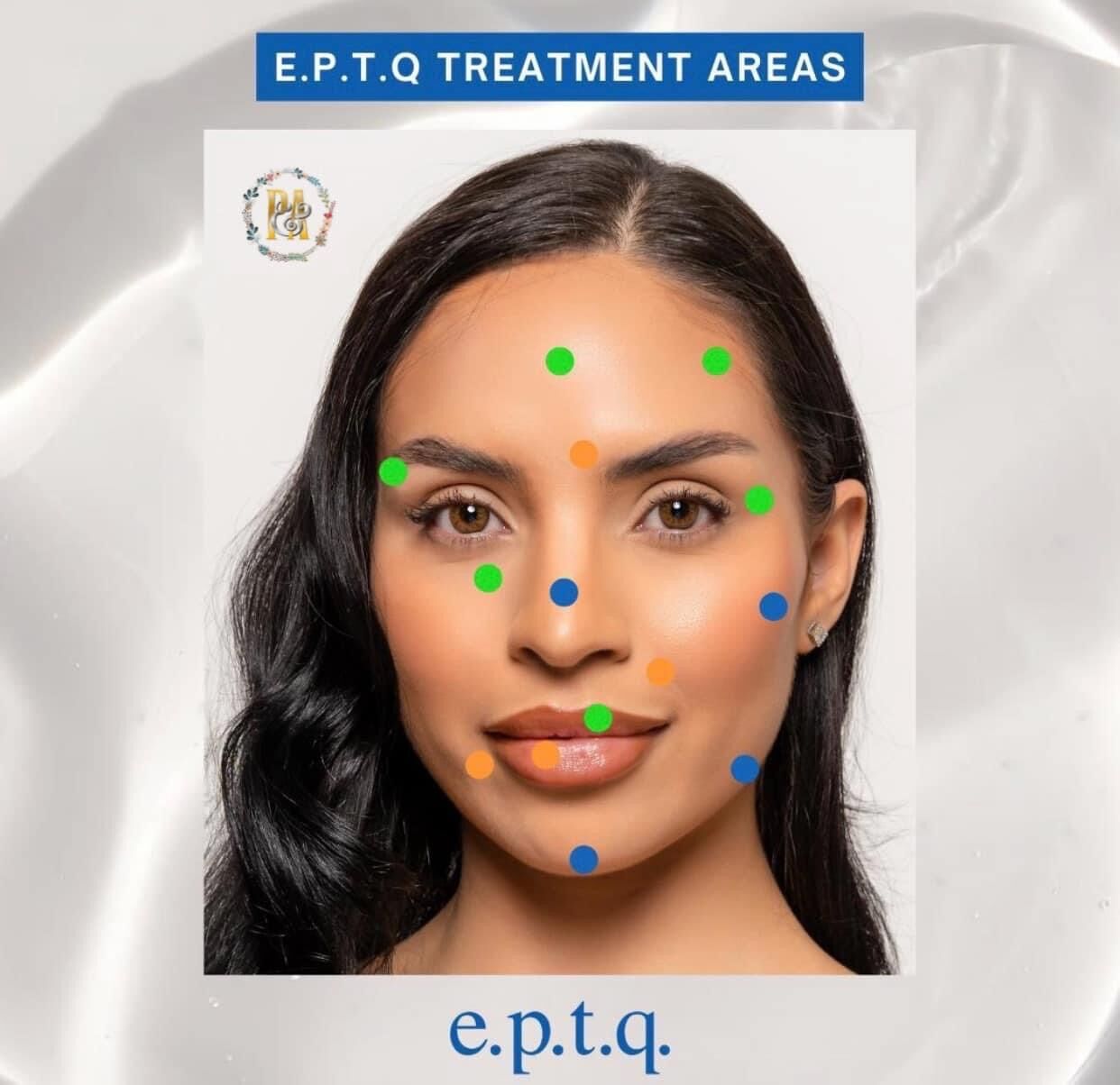 (CHÍNH HÃNG) Filler EPTQ Hàn Quốc