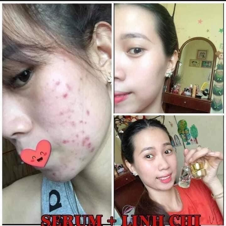 Combo SERUM (lớn) + FACE LINH CHI