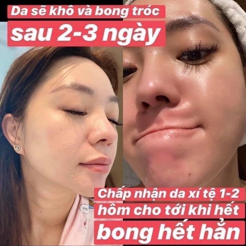 Thay da sinh học Neostrata Peel retinol prosystem