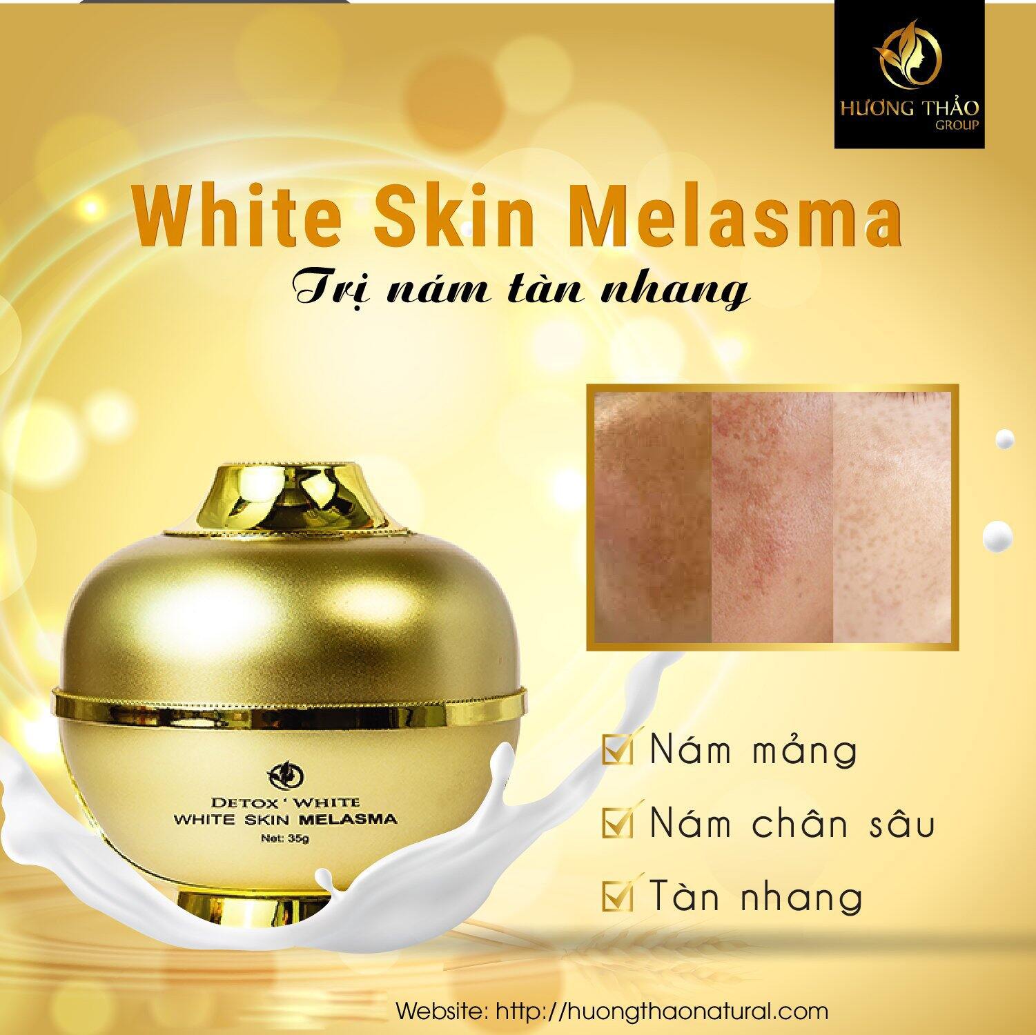 Cao nám melasma