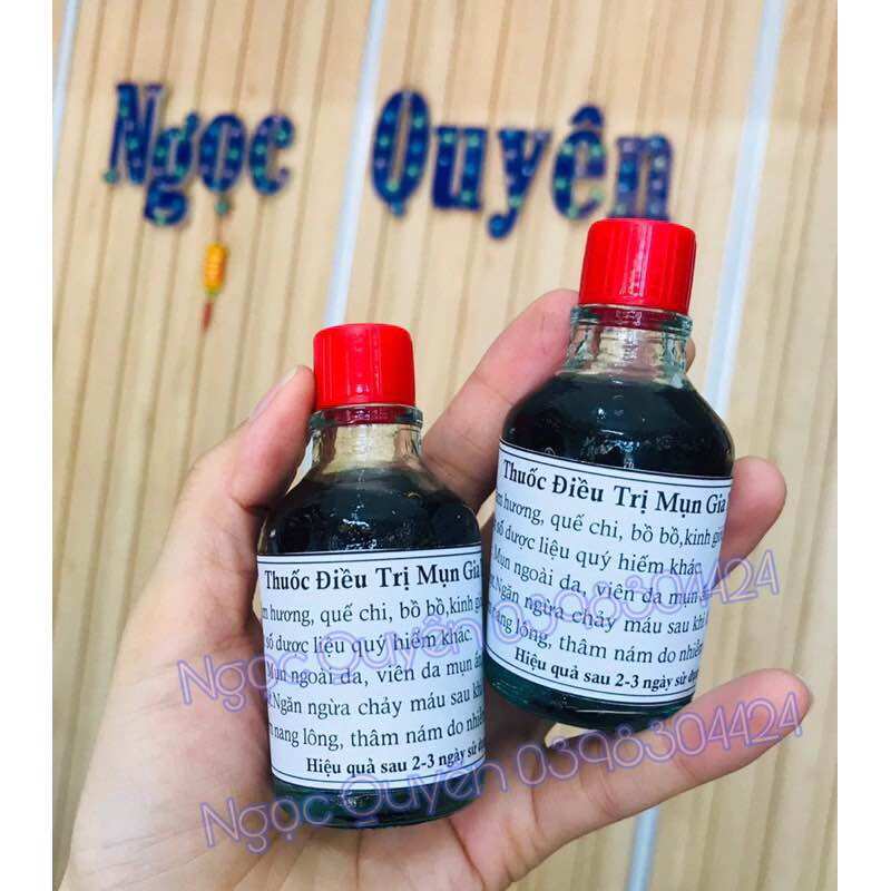 Thuốc chấm mụn đông y gia truyền