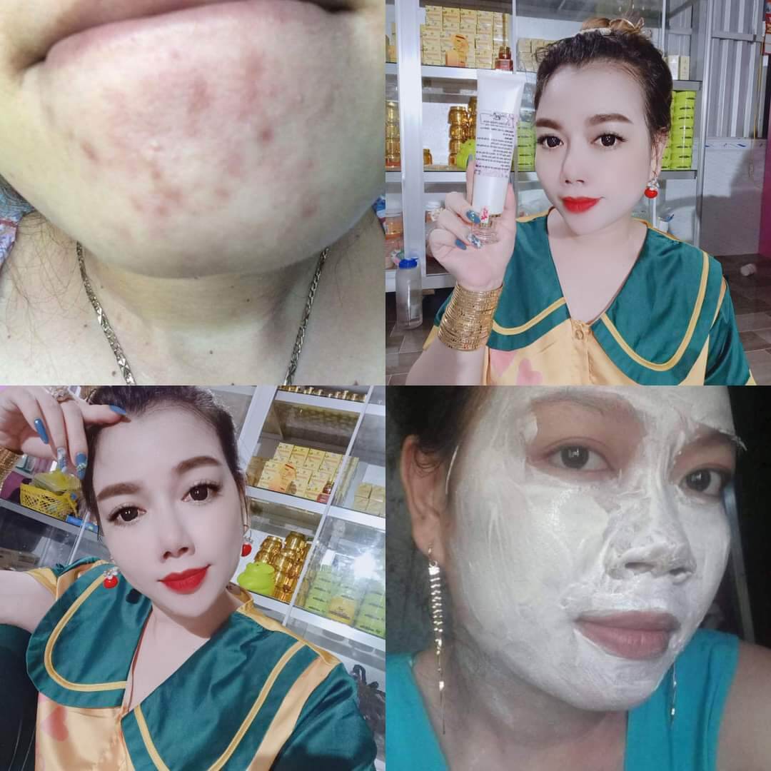 ủ trắng  da mặt phấn hoa.