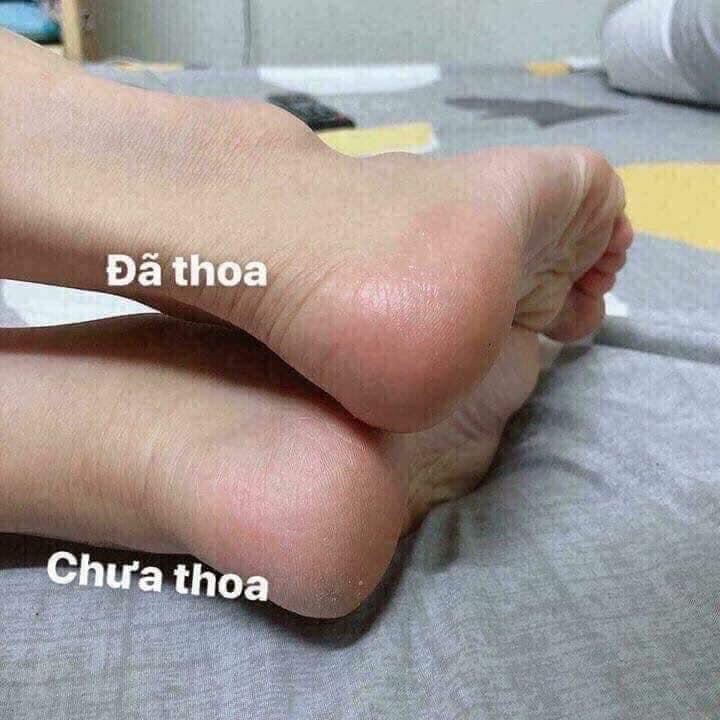 Kem nứt gót chân Thái Lan