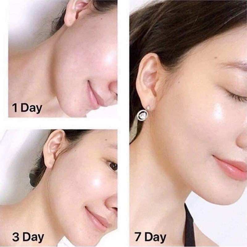 ( Chuẩn Auth) Kem dưỡng trắng Olay
