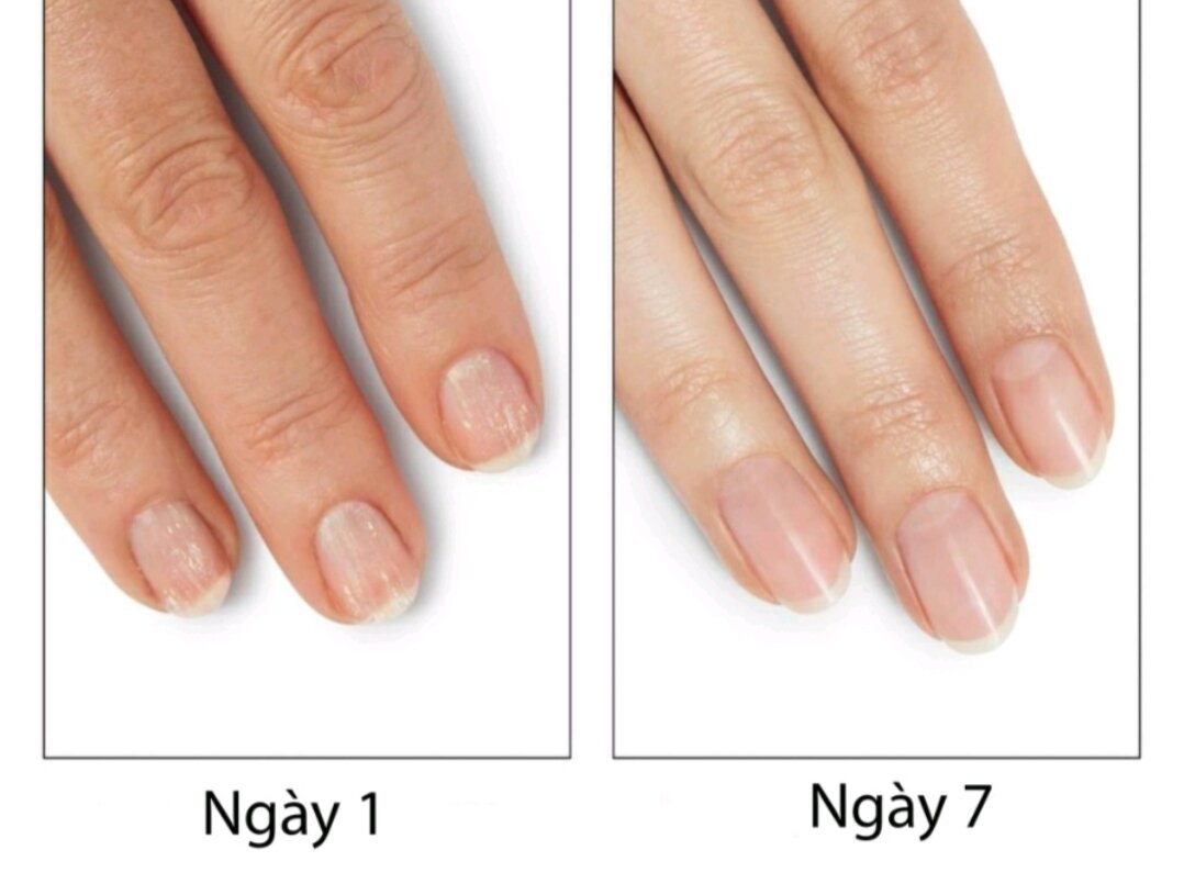 Dưỡng móng + phục hồi hư tổn CND