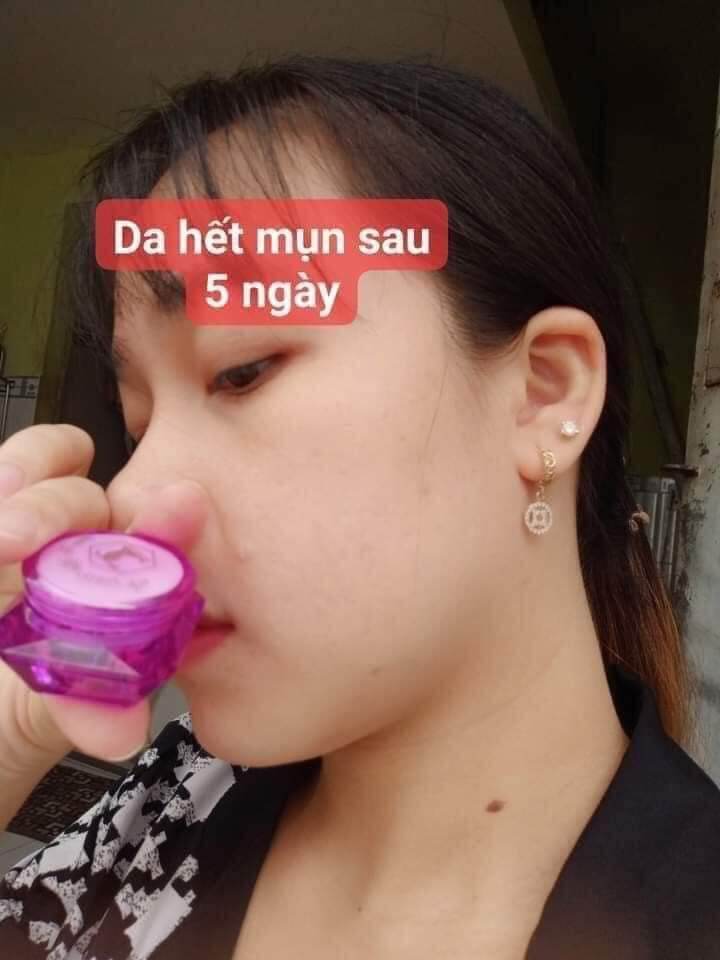 COMBO 2 HỘP KEM MỤN 2C MỸ PHẨM VIỆT