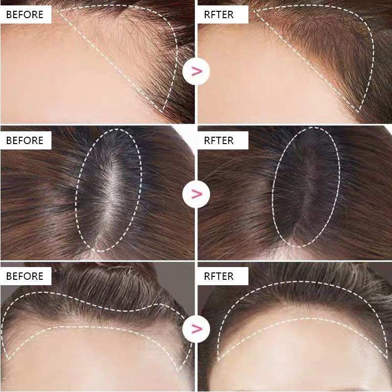 Suake Phấn Phủ chấm hói che khuyết điểm chân tóc đa năng