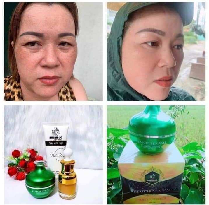 Kem nám Huỳnh Đỗ