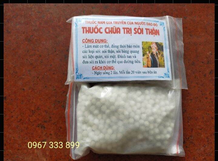 Khắc tinh của bệnh Sỏi thận, sỏi bàng quang, sỏi liệu quản, sỏi mật