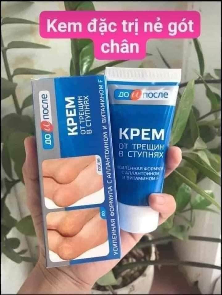 Kem nứt gót chân Nga Kpem giúp dưỡng ẩm, làm mềm da chân