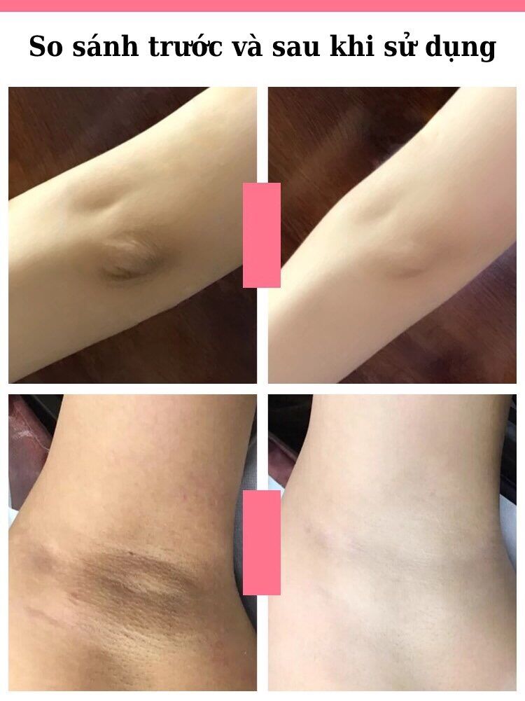 Xà Phòng Trái Đào Trị Thâm Mông Thâm Đầu Gối Sáng Da