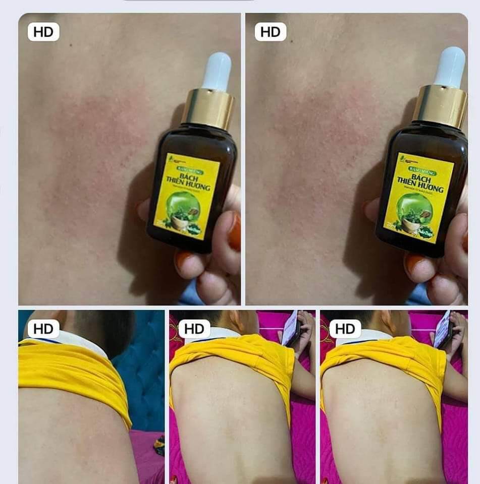 Tinh dầu răng miệng Bách Thiên Hương