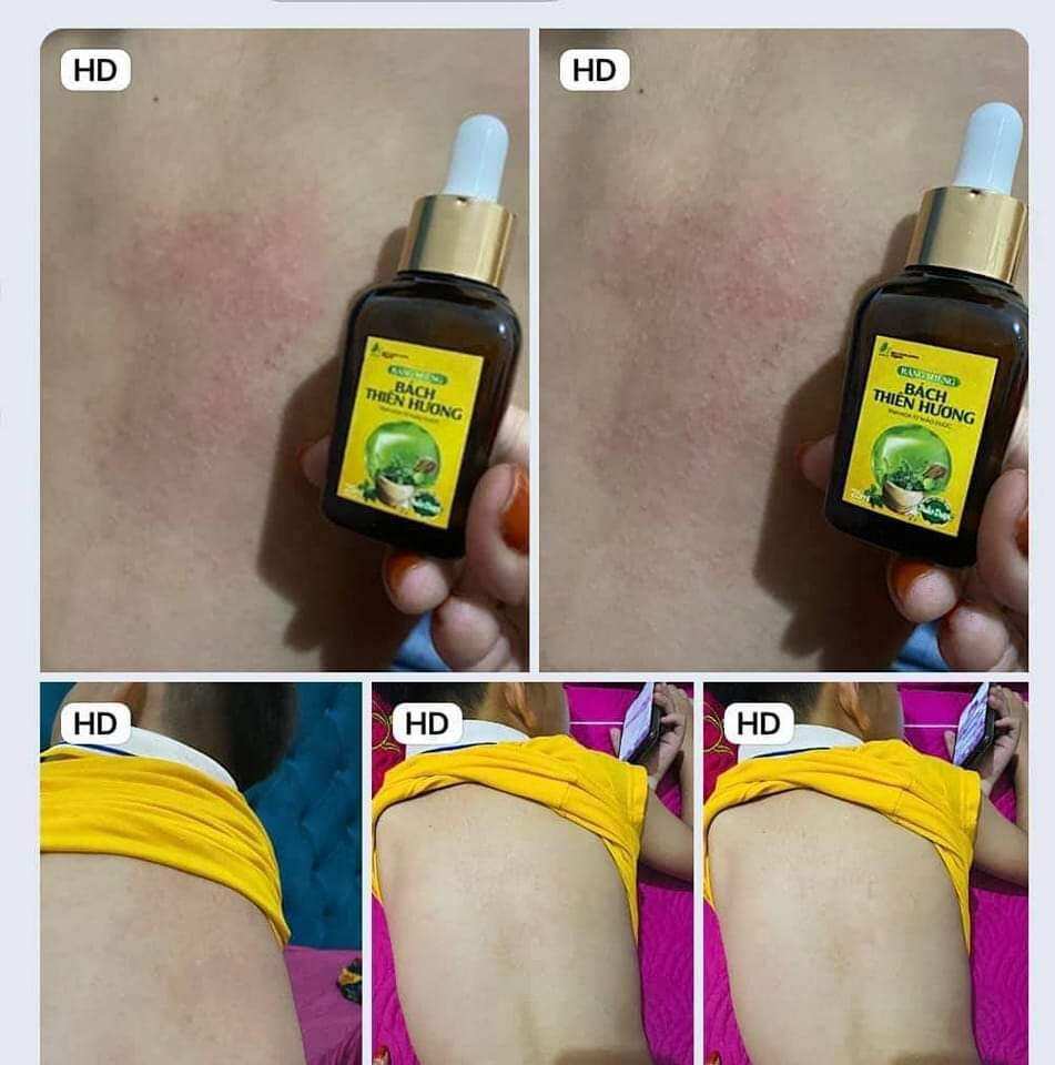 Tinh dầu răng miệng Bách Thiên Hương