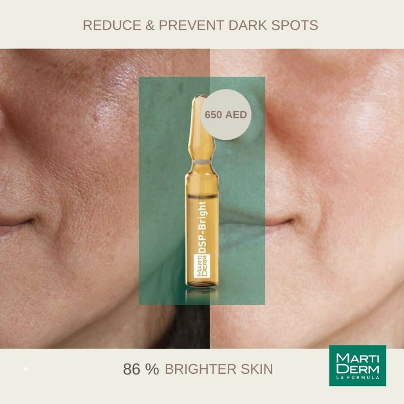 Ampole dưỡng trắng , đều màu da DSP MartiDerm