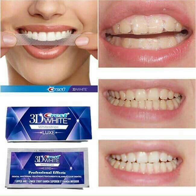 Hộp 7 Gói 2 miếng dán trắng răng tiện lợi 3D White Teeth Whitening Strips