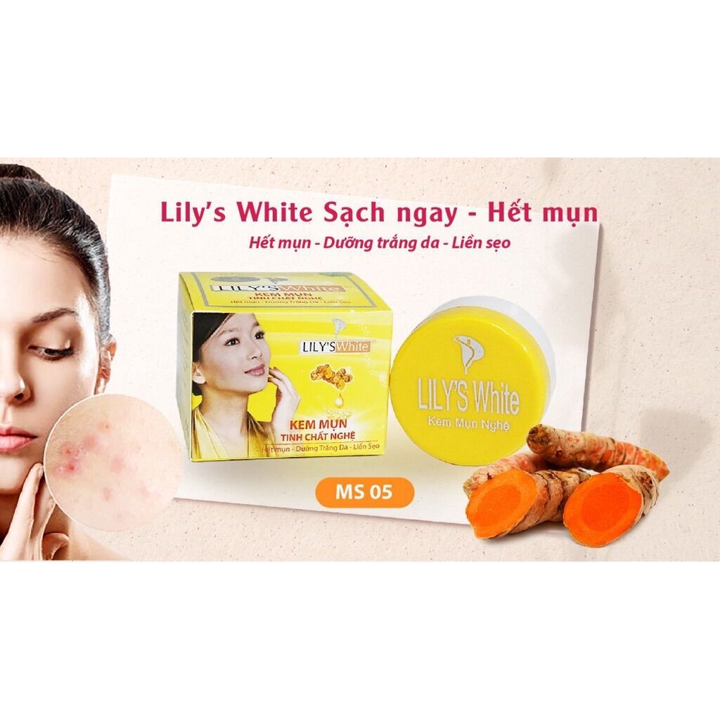 Kem mụn trắng da xóa thâm, liền sẹo Lily’s white tinh chất nghệ