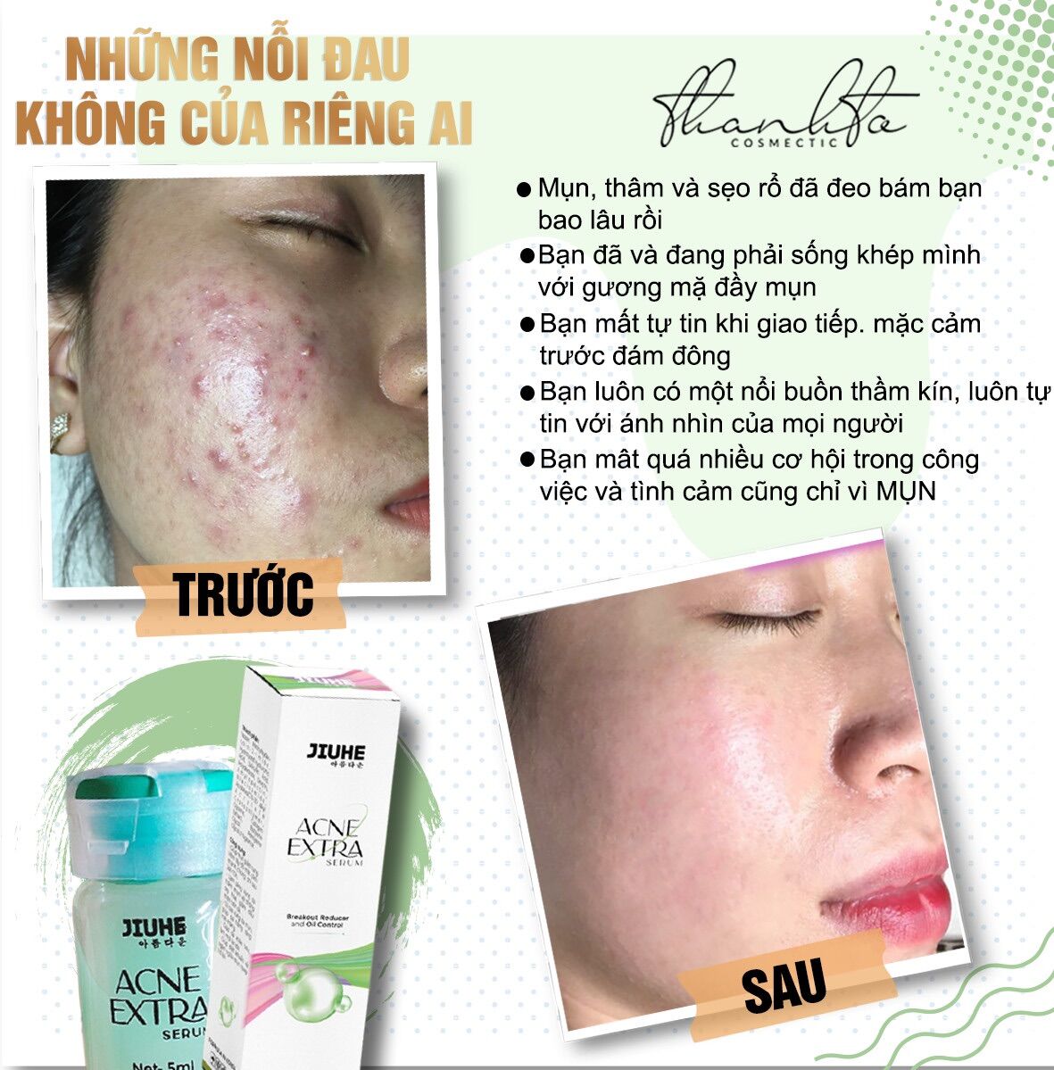 [HCM]COMBO KEM FACE JIUHE VÀ SERUM JIUHE MỤN ACNE EXTRA