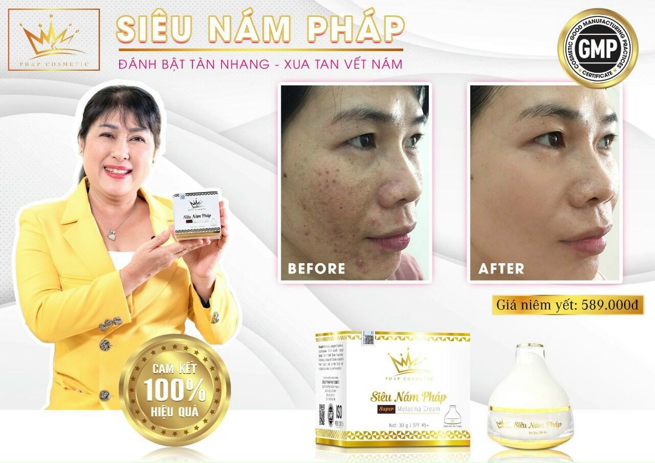 Kem face siêu nám pháp cosmetic spf 45+