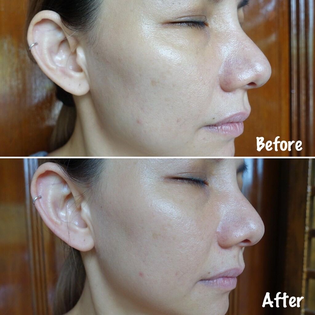[Sample] Dưỡng da Murad 1.5