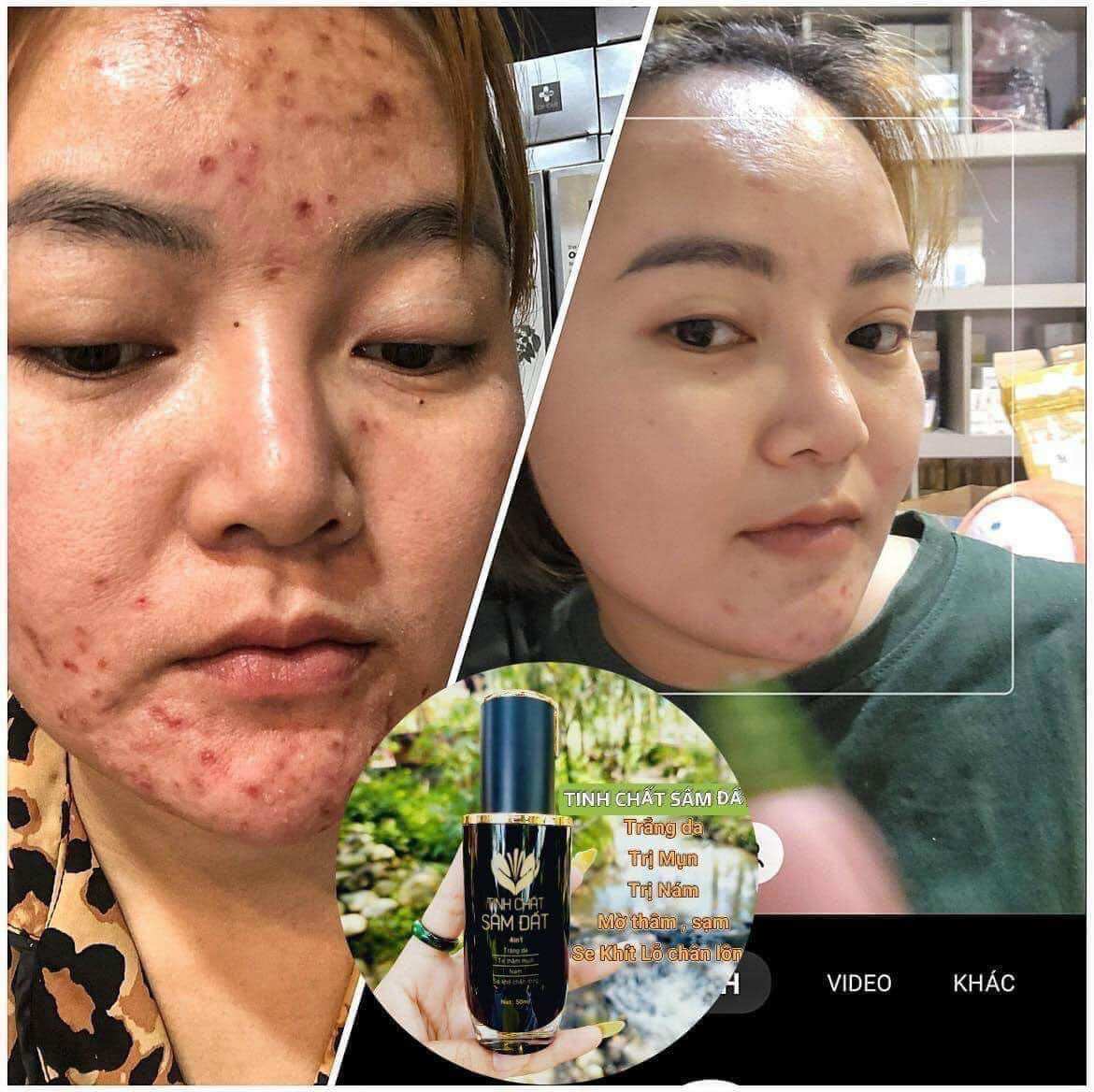 Tinh Chất Sâm Đất DR CELL 50ml